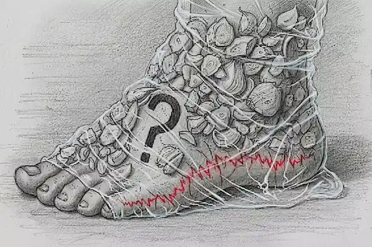 Schizzo a matita di un piede coperto da bucce d'aglio, con un punto interrogativo accanto